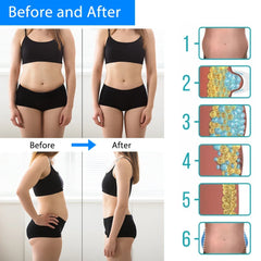 Cryotherapy Fat Freezing Slimming Machine – Anti-Cellulite Cold Therapy Massager